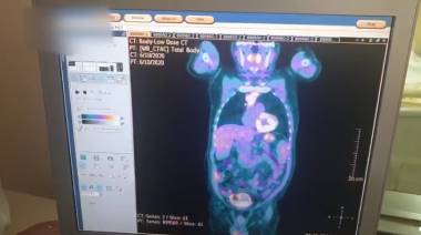 Հայաստանում կատարվեց առաջին Պոզիտրոն-էմիսիոնային տոմոգրաֆիան (ՊԷՏ/ՀՏ)` 10-ամյա սպասումից հետո